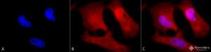 Immunocytochemistry/Immunofluorescence analysis of human HeLa cells, fixed in 2% formaldehyde for 20 minutes at room temperature, using Anti-Phosphotyrosine Antibody (A304808), at 1:50 for 12 hours at 4°C