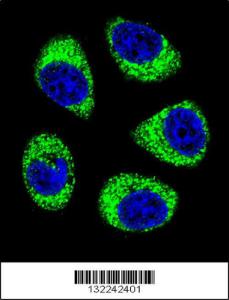 Anti-SLC25A6 Rabbit Polyclonal Antibody (Biotin)