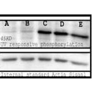 Western blot analysis of mouse Spleen lysates showing detection of Phosphoserine protein using Anti-Phosphoserine Antibody (A304809) at 1:1,000. Bands are responsive to treatment with varying long UV wavelengths: A(0), B(50), C(200), D(400), and E (treated with 0.1µM okadaic acid).