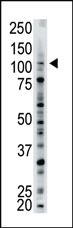 Anti-USP15 Rabbit Polyclonal Antibody