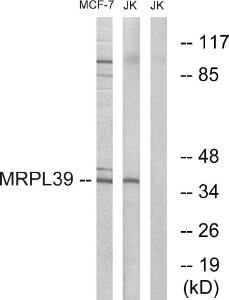 Anti-MRPL39 antibody