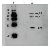 Anti-HIV1 p24 Antibody (Biotin