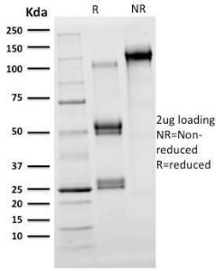 SDS-PAGE analysis of Anti-OLIG2 Antibody [OLIG2/2400] under non-reduced and reduced conditions; showing intact IgG and intact heavy and light chains, respectively SDS-PAGE analysis confirms the integrity and purity of the antibody