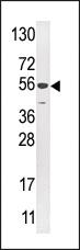 Anti-USP16 Rabbit Polyclonal Antibody