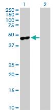 Anti-MAGEA4 Rabbit Polyclonal Antibody