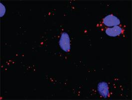 Anti-ATF4 + CREBBP Antibody Pair