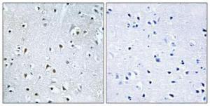 Immunohistochemical analysis of paraffin-embedded human brain using Anti-POLDIP3 Antibody 1:100 (4°C overnight) The right hand panel represents a negative control, where the antibody was pre-incubated with the immunising peptide