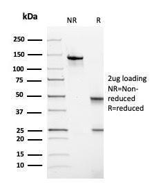 Anti-Thyroid Peroxidase Mouse Monoclonal Antibody [clone: TPO/3697]