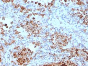 Immunohistochemical analysis of formalin-fixed, paraffin-embedded human lymph node using Anti-TIM3 Antibody [TIM3/4028]