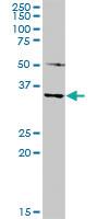 Anti-MAGEA4 Rabbit Polyclonal Antibody