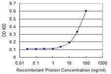 Anti-Thioredoxin Domain Containing 4 Mouse Monoclonal Antibody [clone: 3C7]