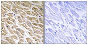 Anti-MRPL39 antibody