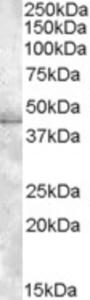 EB09045 (1 µg/ml) staining of HeLa lysate (35 µg protein in RIPA buffer). Primary incubation was 1 hour. Detected by chemiluminescence.