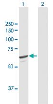 Anti-SQLE Mouse Polyclonal Antibody