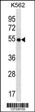 Anti-LAX1 Rabbit Polyclonal Antibody (HRP (Horseradish Peroxidase))