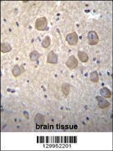 Anti-OR4K2 Rabbit Polyclonal Antibody (FITC (Fluorescein Isothiocyanate))