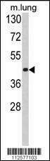 Anti-LAMP1 Rabbit Polyclonal Antibody (AP (Alkaline Phosphatase))