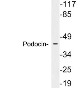 Western blot analysis of lysates from 293 cells using Anti-Podocin Antibody