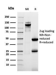 SDS-PAGE analysis of Anti-MUC1 Antibody [rMUC1/955] under non-reduced and reduced conditions; showing intact IgG and intact heavy and light chains, respectively. SDS-PAGE analysis confirms the integrity and purity of the antibody.