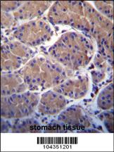 Anti-USP20 Rabbit Polyclonal Antibody