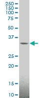 Anti-MAGEA4 Mouse Monoclonal Antibody [clone: 3D12]