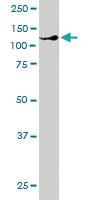 Anti-HPS3 Goat Polyclonal Antibody