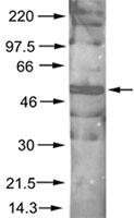 Anti-AKT1 Rabbit Polyclonal Antibody