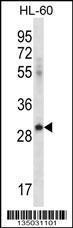 Anti-ICOSLG Rabbit Polyclonal Antibody (HRP (Horseradish Peroxidase))