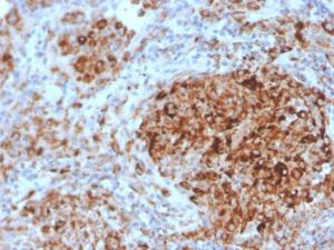 Immunohistochemical analysis of formalin-fixed, paraffin-embedded human tonsil using Anti-TIM3 Antibody [TIM3/4028]