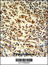 Anti-HMHA1 Rabbit Polyclonal Antibody