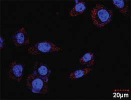 Anti-MAPK3 + DUSP1 Antibody Pair