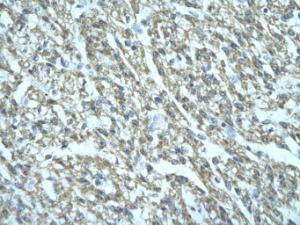 Anti-FGD1 Rabbit Polyclonal Antibody