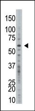 Anti-USP21 Rabbit Polyclonal Antibody