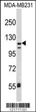 Anti-ITGAX Rabbit Polyclonal Antibody