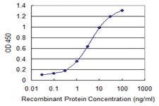 Anti-PIGP Mouse Monoclonal Antibody [clone: 2E7]