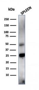 Western blot analysis of human spleen lysate using Anti-TIM3 Antibody [TIM3/4028]