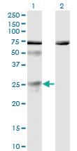 Anti-TWSG1 Mouse Monoclonal Antibody [clone: 6E6]