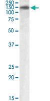 Anti-PLA2R1 Goat Polyclonal Antibody