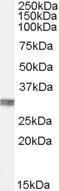 Anti-CLIC4 Antibody (A84333) (01 µg/ml) staining of Human Kidney lysate (35 µg protein in RIPA buffer) Primary incubation was 1 hour Detected by chemiluminescence