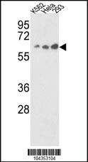 Anti-USP21 Rabbit Polyclonal Antibody