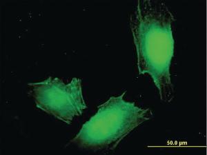 Anti-MAGEA4 Mouse Monoclonal Antibody [clone: 3D12]