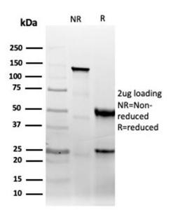 SDS-PAGE analysis of Anti-CD47 Antibody [CD47/6364R] under non-reduced and reduced conditions; showing intact IgG and intact heavy and light chains, respectively SDS-PAGE analysis confirms the integrity and purity of the antibody