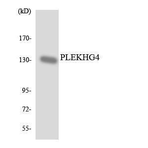 Western blot analysis of the lysates from HUVEC cells using Anti-PLEKHG4 Antibody