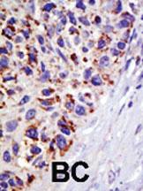 Anti-USP21 Rabbit Polyclonal Antibody