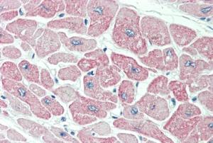 Anti-CLIC4 Antibody (A84333) (5 µg/ml) staining of paraffin embedded Human Heart Steamed antigen retrieval with citrate buffer pH 6, AP-staining