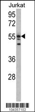 Anti-USP22 Rabbit Polyclonal Antibody