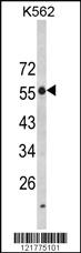 Anti-CHSY1 Rabbit Polyclonal Antibody