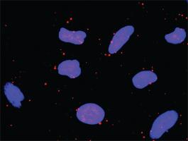 Anti-ATF4 + FOS Antibody Pair