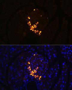 Immunofluorescence analysis of rat pancreas using Anti-Glucagon Antibody [ARC1143] (A308918) at a dilution of 1:100. DAPI was used to stain the cell nuclei (blue).