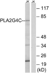 Western blot analysis of lysates from Jurkat cells using Anti-PLA2G4C Antibody. The right hand lane represents a negative control, where the antibody is blocked by the immunising peptide.